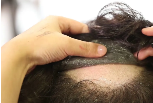 Lace Front Glue Remover